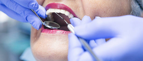 Best Emergency Dental Filling Replacement  in Milford, UT